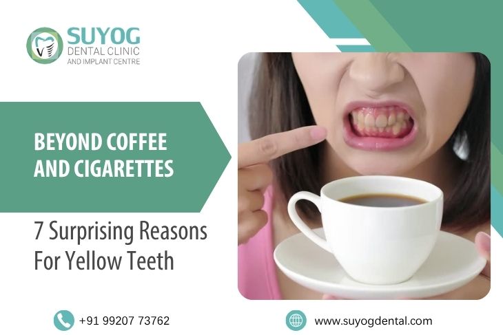 Beyond Coffee and Cigarettes: 7 Surprising Reasons for Yellow Teeth