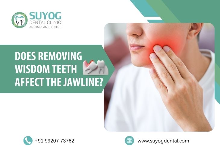 Does Removing Wisdom Teeth Affect the Jawline?
