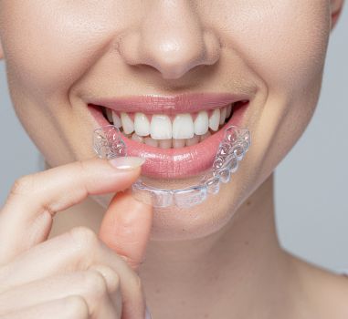 braces treatment in mahim