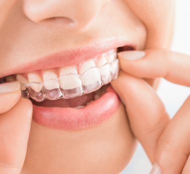 braces treatment in mahim
