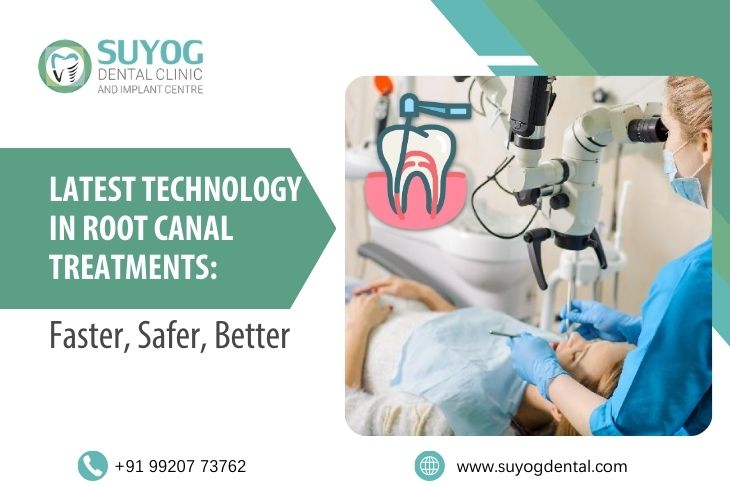 Latest Technology in Root Canal Treatments: Faster, Safer, Better