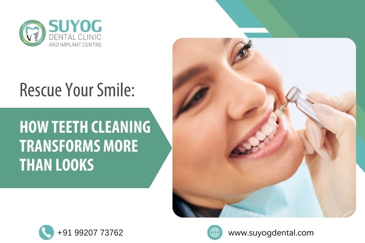 Rescue Your Smile: How Teeth Cleaning Transforms More Than Looks