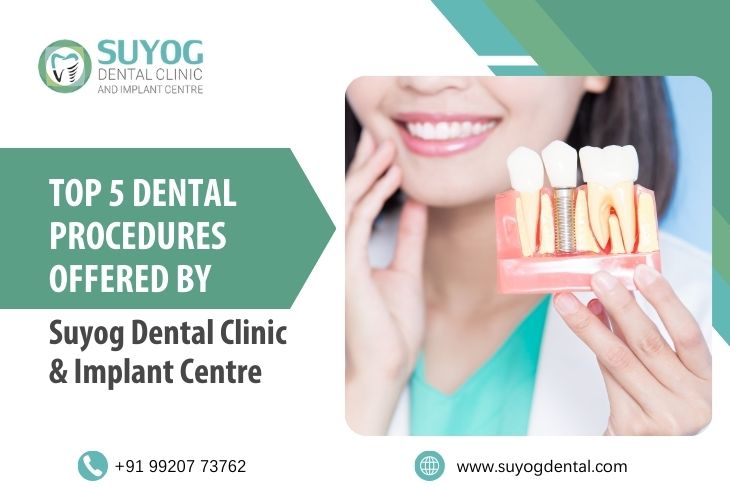 Top 5 Dental Procedures Offered By Suyog Dental Clinic And Implant Centre