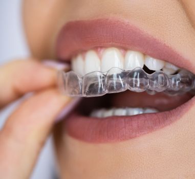 braces treatment in mahim