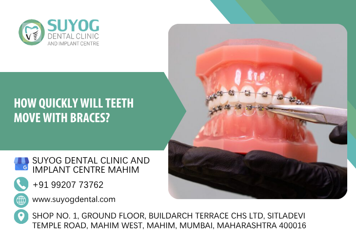 How quickly will teeth move with braces?