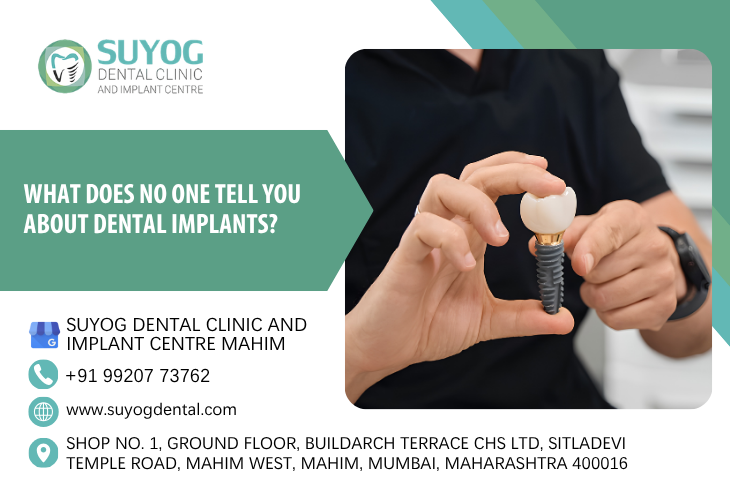 What Does No One Tell You About Dental Implants?