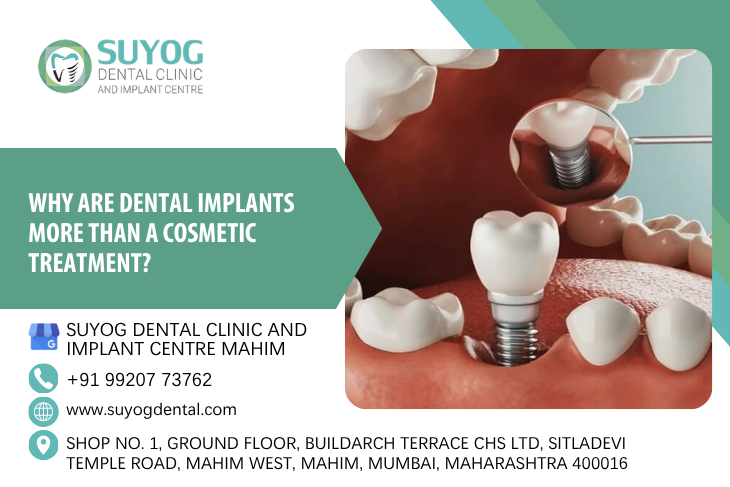 dental implant treatment in mahim west